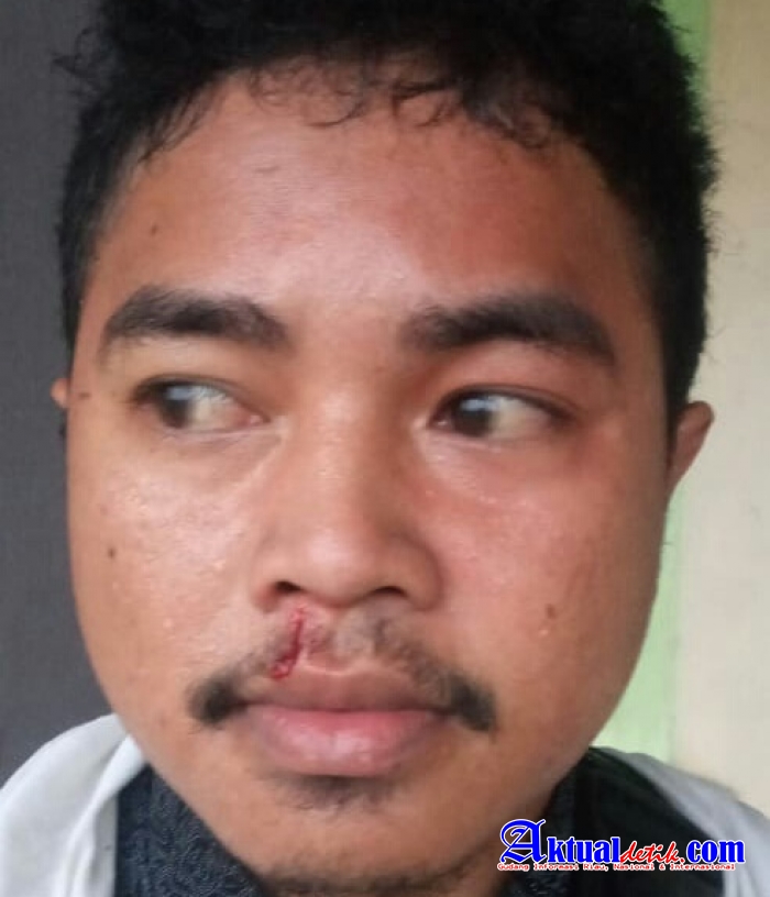 Kades Tokona Aktor dari Penganiayaan Jurnalis Sidikkasus Biro Halsel