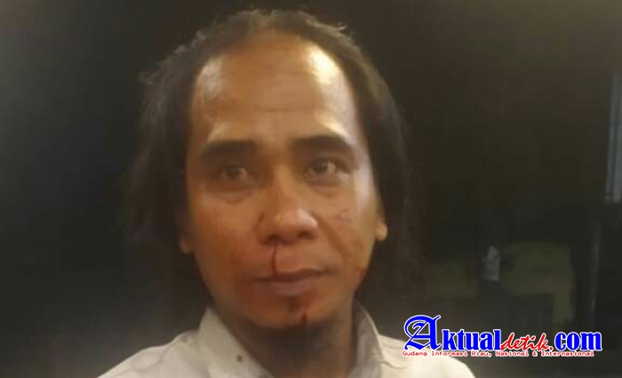 Rozi Al-Banjari Ketua Ommbak Sumut Dikeroyok OTK Di Kafe Perbaungan