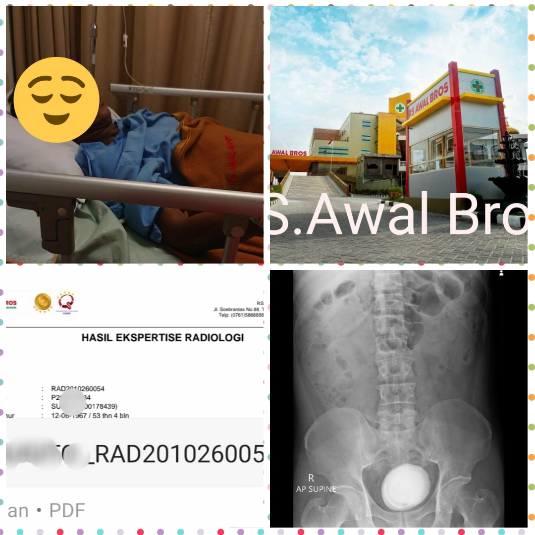 Pasien Meninggal, Diduga Kuat RS Awal Bros Panam Mal Praktik & Berdalih Covid