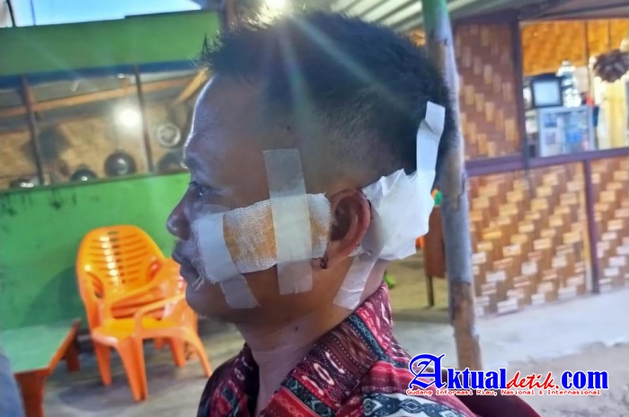 Kepala Obaza Alami Luka Berat, Dianiaya Preman, Polisi Diminta Profesional