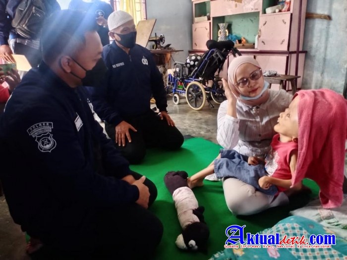 Kasat Reskrim Polres Sergai Sambangi Kediaman Rizqy Penderita Hidrosefalus
