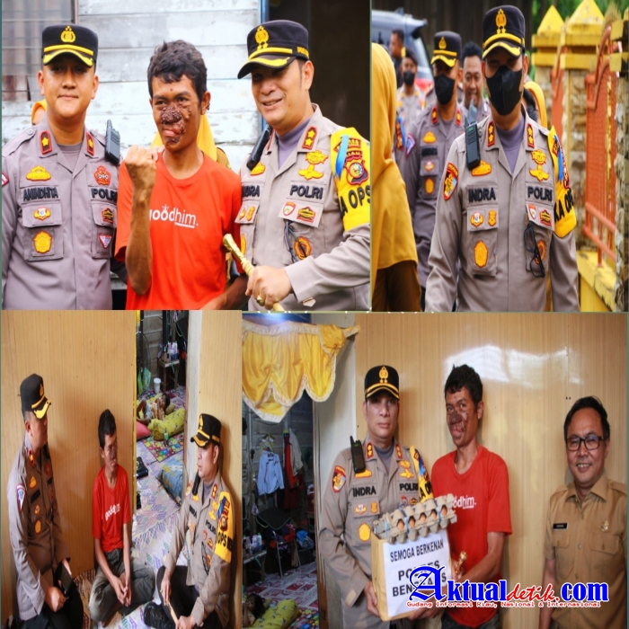 Peduli Warga,Kapolres Bengkalis Bantu Penderita Penyakit Kanker Kulit Berobat ke Rumah Sakit